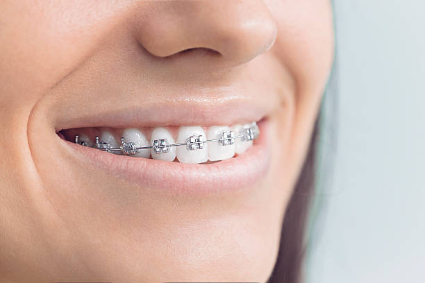 Best Invisalign and Clear Aligners  in Bear Creek, FL